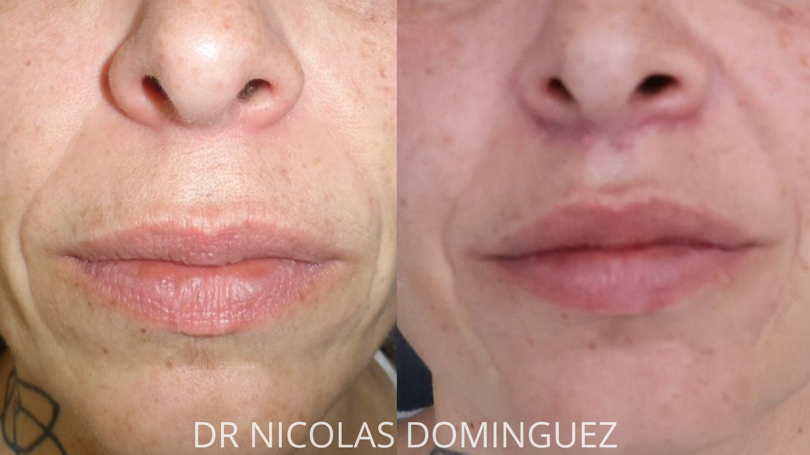 Dr Nico Dominguez - Instagram 1080 x 1350px (1920 x 1080 px)-2