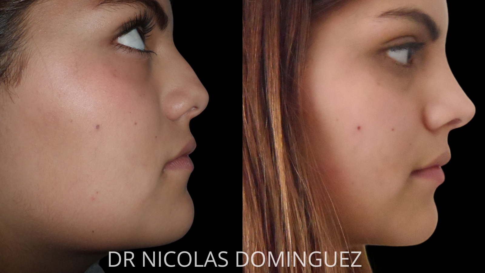 Dr Nico Dominguez - Instagram 1080 x 1350px (1920 x 1080 px)-3